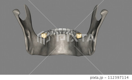 The mandibular third molar is also referred as the wisdom tooth 112397114