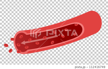 血管の流れと赤血球の説明図　医療イラスト 112416749