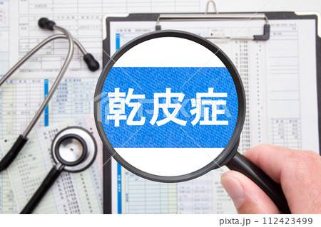 乾皮症　医療イメージ 112423499