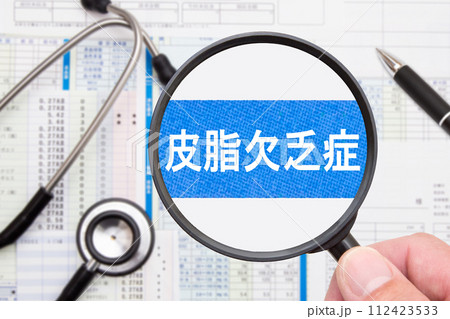 皮脂欠乏症 医療イメージ 皮脂欠乏症 医療イメージ 112423533