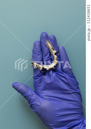 Metal Frame Lower Partial Denture, Cobalt Chrome Dental Plate, Bridge Printed By 3d Printer in Doctor's Hand. Blue Background. Flat Lay Mockup. Copy Space For Text.Vertical. Dentistry 112438651