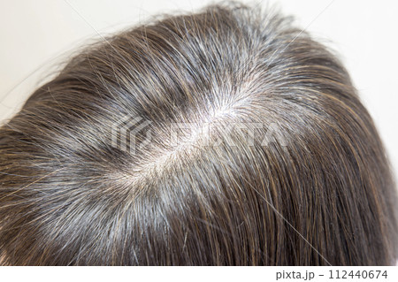 カラーリングした髪の毛　頭頂部 112440674