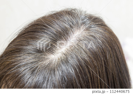 カラーリングした髪の毛 頭頂部 カラーリングした髪の毛 頭頂部 112440675
