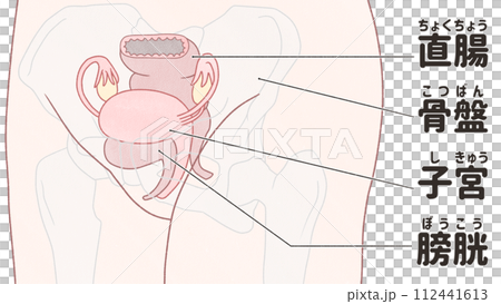 斜めから見た子宮の位置　わかりやすい日本語図解イラスト 112441613