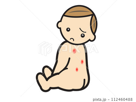 背中に発疹のある赤ちゃん 112460488