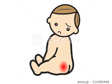 おしりに赤みがある赤ちゃん 112460489