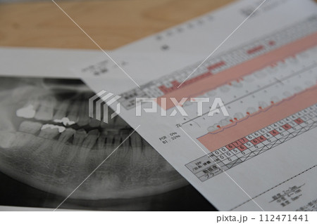 歯医者で撮影されたレントゲン写真と歯周病検査表 112471441