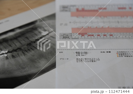 歯医者で撮影されたレントゲン写真と歯周病検査表 歯医者で撮影されたレントゲン写真と歯周病検査表 112471444