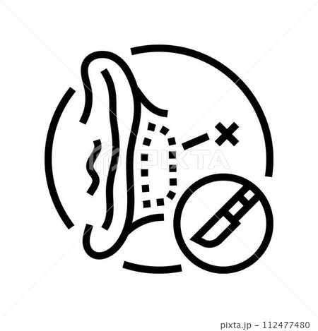 otoplasty surgery line icon vector illustration 112477480