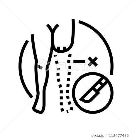 limb amputation surgery line icon vector illustration 112477486