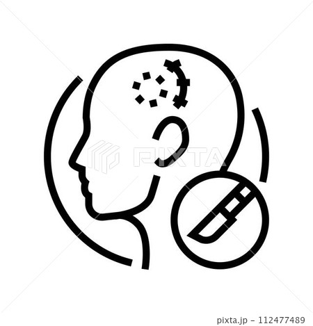 craniotomy surgery line icon vector illustration 112477489