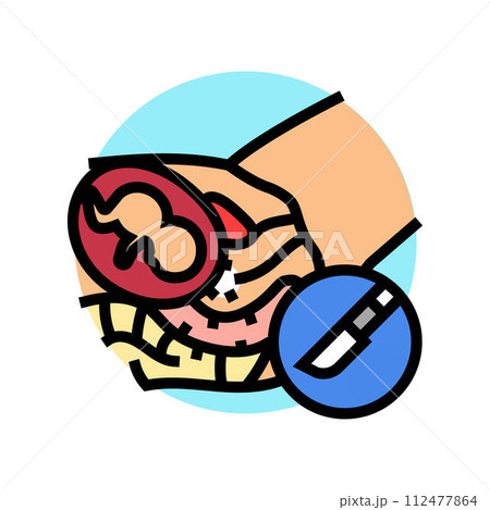 cervical cerclage surgery color icon vector illustration cervical cerclage surgery color icon vector illustration 112477864