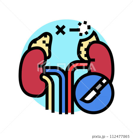 adrenalectomy surgery color icon vector illustration adrenalectomy surgery color icon vector illustration 112477865