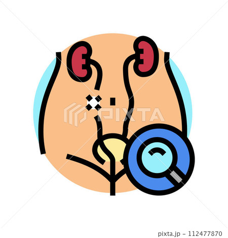 ureteroscopy surgery color icon vector illustration ureteroscopy surgery color icon vector illustration 112477870