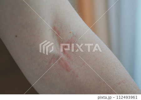 43 years old 112493961