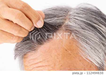 シニア男性 ヘアケア 生え際 アップ シニア男性 ヘアケア 生え際 アップ 112494630