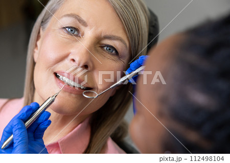 Multicultural woman dentist with female patient in stomatology clinic Multicultural woman dentist with female patient in stomatology clinic 112498104