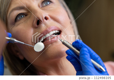 Woman sitting in dental chair teeth treatment 112498105
