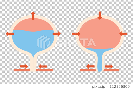 正常な膀胱の医療イラスト、排尿の仕組み 112536809
