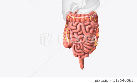 Epiploic appendages are normal outpouchings of peritoneal fat on the anti-mesenteric surface of the colon Epiploic appendages are normal outpouchings of peritoneal fat on the anti-mesenteric surface of the colon 112540063
