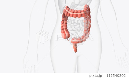 The colon is also known as the large bowel or large intestine 112540202