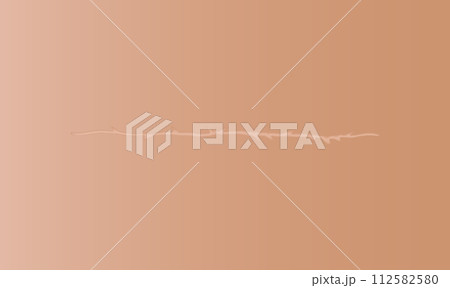 Healing wounds, skin scar, stitched gash and cut. Realistic surgical suture, stitched wounds. Healing stage on human skin background. Vector illustration Healing wounds, skin scar, stitched gash and cut. Realistic surgical suture, stitched wounds. Healing stage on human skin background. Vector illustration 112582580