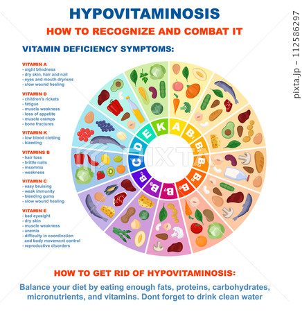Vitamins infographic and vitamin deficiency symptoms. Food sources of different organic molecule for proper metabolism. Healthy eating and diet. Flat vector illustration Vitamins infographic and vitamin deficiency symptoms. Food sources of different organic molecule for proper metabolism. Healthy eating and diet. Flat vector illustration 112586297