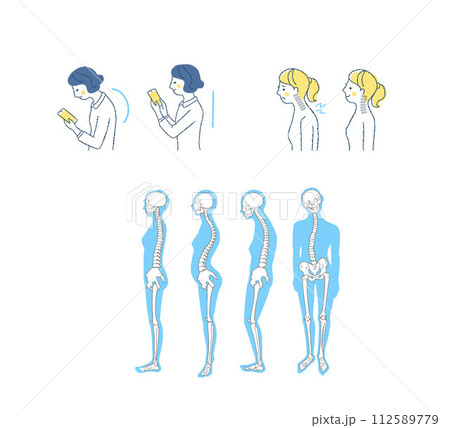 正しい姿勢と悪い姿勢 ストレートネック 正しい姿勢と悪い姿勢 ストレートネック 112589779