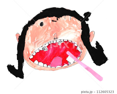 子供の虫歯予防デー　 112605323