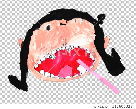 子供の虫歯予防デー　 112605323