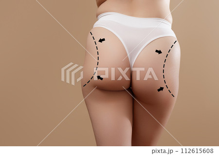 Female body with the drawing arrows. Buttocks, hip 112615608
