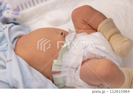 The navel of a newborn baby. Closeup. First weeks of life. The navel of a newborn baby. Closeup. First weeks of life. 112615964