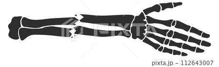 Broken hand bones. Bone fracture. Injury icon 112643007