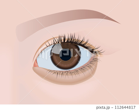 目の下のくま 目の下のくま 112644817