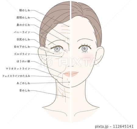 顔半分　シワたるみ顔　名称あり 112645141