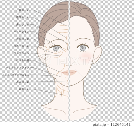 顔半分　シワたるみ顔　名称あり 112645141