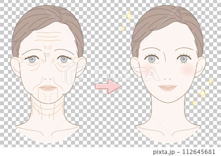 皺紋和下垂的女人前後插圖 112645681