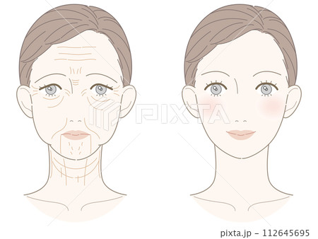 シワたるみ 改善 女性 イラスト シワたるみ 改善 女性 イラスト 112645695