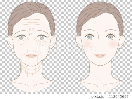 シワたるみ 改善 女性 イラスト シワたるみ 改善 女性 イラスト 112645695