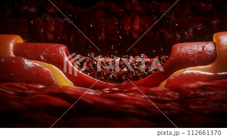 blood stream and cigarette butts. smoking health harm concept. Inside human body. 3d rendering. 112661370