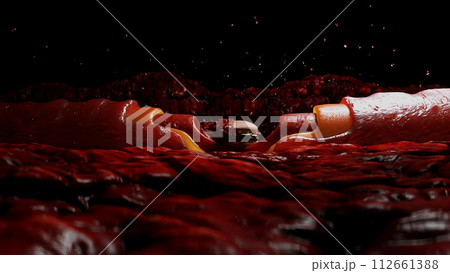 junk food. blood stream and cholesterol plaque, thrombus. health harm concept. Inside human body. junk food. blood stream and cholesterol plaque, thrombus. health harm concept. Inside human body. 112661388