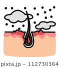 Skin allergy from particle pollution flat color	 112730364