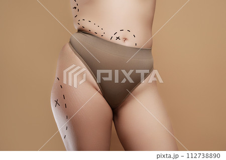 Overweight woman with fat cellulite legs and Overweight woman with fat cellulite legs and 112738890