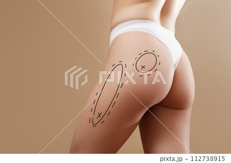 Overweight woman with fat cellulite legs and Overweight woman with fat cellulite legs and 112738915