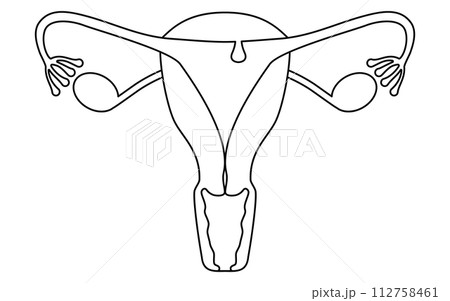 子宮内膜ポリープの図解イラスト、子宮・卵巣の解剖図 112758461