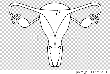 子宮内膜ポリープの図解イラスト、子宮・卵巣の解剖図 112758461