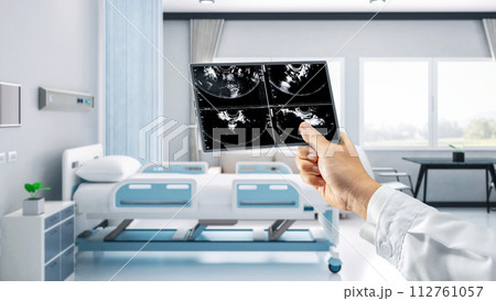 Doctor or sonographer with x-ray film 112761057
