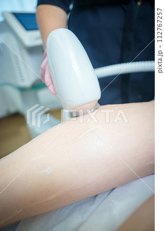 Closeup view of a gloved hand expertly performing a precise laser hair removal procedure on a smooth, already hairless leg, within the clean, sterile confines of a professional beauty salon setting. Closeup view of a gloved hand expertly performing a precise laser hair removal procedure on a smooth, already hairless leg, within the clean, sterile confines of a professional beauty salon setting. 112767257