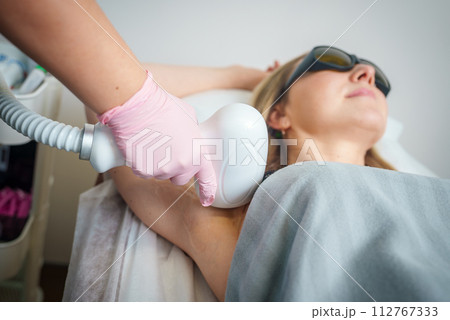 A woman undergoes a laser hair removal treatment at a salon, her face relaxed, wearing protective goggles, as a technician in pink gloves applies the device to her underarm. A woman undergoes a laser hair removal treatment at a salon, her face relaxed, wearing protective goggles, as a technician in pink gloves applies the device to her underarm. 112767333