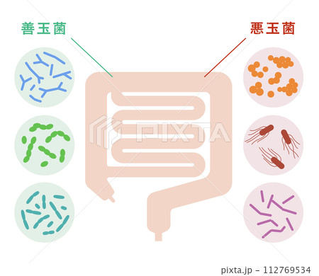 腸内細菌による医療イラスト　善玉菌　悪玉菌 112769534